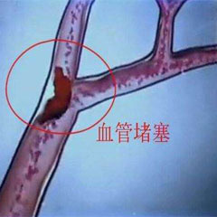 做好“四個一”，不犯心腦血管?。? /></a></div>
                        </div>
                        <!-- end of typo-img -->
                        <div   id=